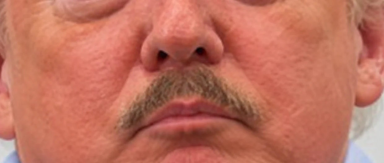 Close crop of the iconic moustache